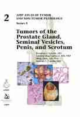  Tumors of the Prostate Gland, Seminal Vesicles, Penis, and Scrotum | Buch |  Sack Fachmedien