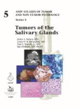  TUMORS OF THE SALIVARY GLANDS | Buch |  Sack Fachmedien