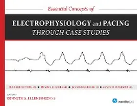 Tung / Guha / Ellenbogen |  Essential Concepts of Electrophysiology and Pacing through Case Studies | eBook | Sack Fachmedien