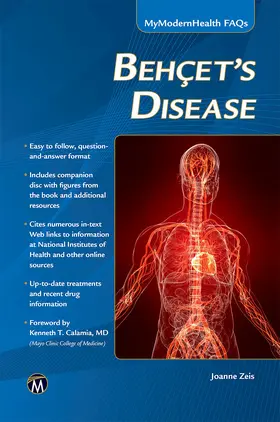 Zeis |  Behcet's Disease | Buch |  Sack Fachmedien