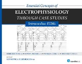 Tung / Frankel / Ellenbogen |  Essential Concepts of Electrophysiology through Case Studies: Intracardiac EGMs | eBook | Sack Fachmedien