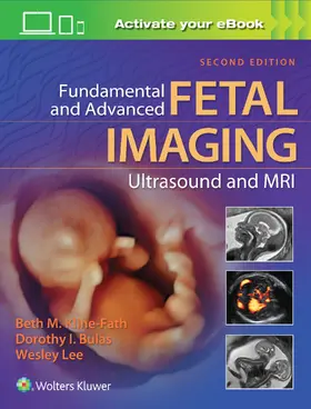 Kline-Fath / Bulas / Lee |  Fundamental and Advanced Fetal Imaging Ultrasound and MRI | Buch |  Sack Fachmedien