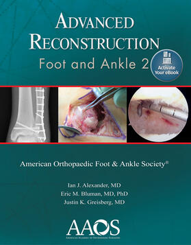 Alexander / Bluman / Greisberg | Alexander, I: Advanced Reconstruction: Foot and Ankle 2: Pri | Buch | 978-1-9751-2267-6 | sack.de