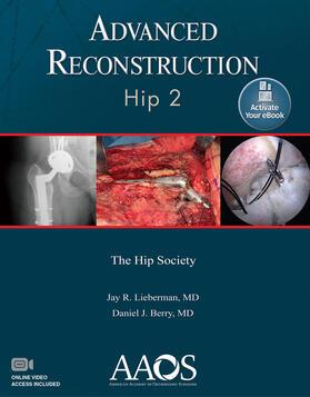 Lieberman / Berry | Advanced Reconstruction: Hip 2: Print + Ebook with Multimedi | Buch | 978-1-9751-2383-3 | sack.de
