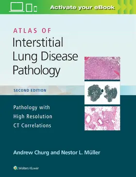 Churg / Müller / Muller |  Atlas of Interstitial Lung Disease Pathology | Buch |  Sack Fachmedien