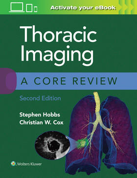 Cox / Hobbs |  Thoracic Imaging: A Core Review | Buch |  Sack Fachmedien
