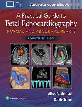 Abuhamad / Chaoui |  A Practical Guide to Fetal Echocardiography | Buch |  Sack Fachmedien