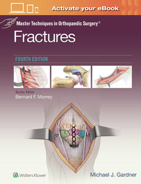Gardner |  Master Techniques in Orthopaedic Surgery: Fractures | Buch |  Sack Fachmedien