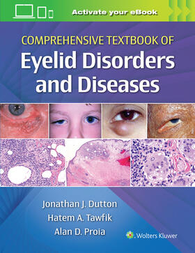 Proia / Dutton / Tawfik |  Comprehensive Textbook of Eyelid Disorders and Diseases | Buch |  Sack Fachmedien