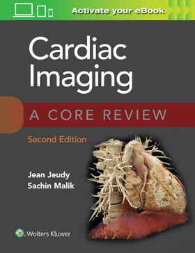 Jeudy / Malik |  Cardiac Imaging: A Core Review | Buch |  Sack Fachmedien