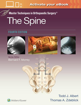 Zdeblick / Albert |  Master Techniques in Orthopaedic Surgery: The Spine | Buch |  Sack Fachmedien