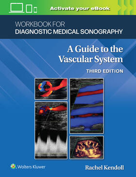 Kupinski |  Workbook for Diagnostic Medical Sonography: The Vascular Systems | Buch |  Sack Fachmedien