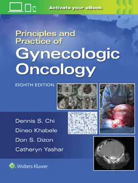 Berchuck / CHI / Yashar |  Principles and Practice of Gynecologic Oncology | Buch |  Sack Fachmedien