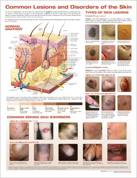  Common Lesions and Disorders of the Skin Anatomical Chart | Sonstiges |  Sack Fachmedien