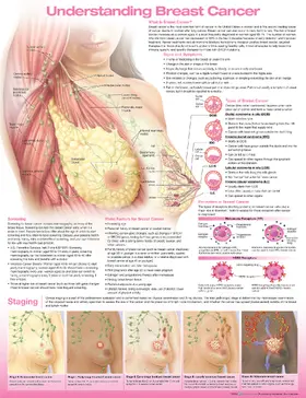 Understanding Breast Cancer Anatomical Chart | Sonstiges | 978-1-9751-9229-7 | sack.de