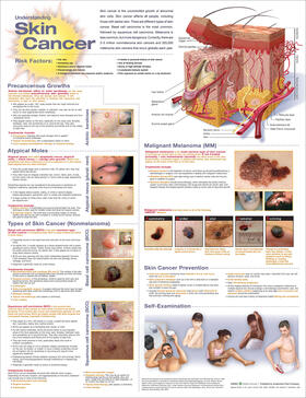  Understanding Skin Cancer Anatomical Chart | Sonstiges |  Sack Fachmedien