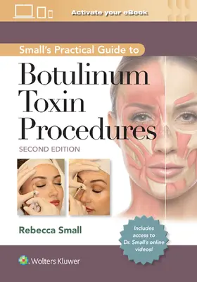 Small |  Small's Practical Guide to Botulinum Toxin Procedures: Print + eBook with Multimedia | Buch |  Sack Fachmedien