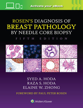 Zhong / Hoda |  Rosen's Diagnosis of Breast Pathology by Needle Core Biopsy | Buch |  Sack Fachmedien