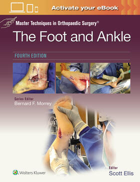 Ellis |  Master Techniques in Orthopaedic Surgery: The Foot and Ankle: Print + eBook with Multimedia | Buch |  Sack Fachmedien