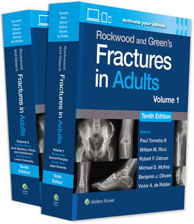 Tornetta |  Rockwood and Green's Fractures in Adults: Print + eBook with    Multimedia | Buch |  Sack Fachmedien