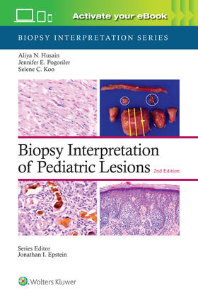 HUSAIN |  Biopsy Interpretation of Pediatric Lesions: Print + eBook with Multimedia | Buch |  Sack Fachmedien