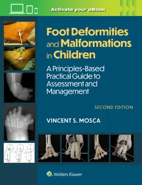 Mosca |  Foot Deformities and Malformations in Children | Buch |  Sack Fachmedien