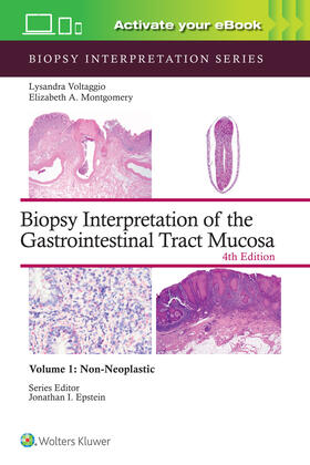 VOLTAGGIO / MONTGOMERY |  Biopsy Interpretation of the Gastrointestinal Tract Mucosa Volume 1 | Buch |  Sack Fachmedien