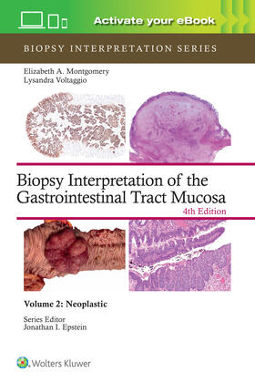 MONTGOMERY / VOLTAGGIO |  Biopsy Interpretation of the Gastrointestinal Tract Mucosa Volume 2 | Buch |  Sack Fachmedien