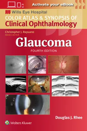 Rhee |  Glaucoma | Buch |  Sack Fachmedien