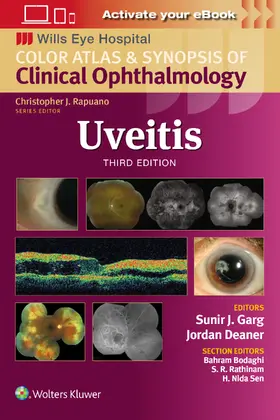 Garg |  Uveitis | Buch |  Sack Fachmedien