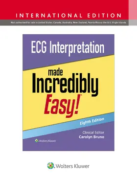 Bruno |  ECG Interpretation Made Incredibly Easy! | Buch |  Sack Fachmedien