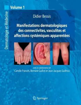 Bessis / Francès / Guillot |  Manifestations dermatologiques des connectivites, vasculites et affections systémiques apparentées | eBook | Sack Fachmedien