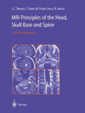 Tamraz / Outin / Forjaz Secca |  MRI Principles of the Head, Skull Base and Spine | Buch |  Sack Fachmedien