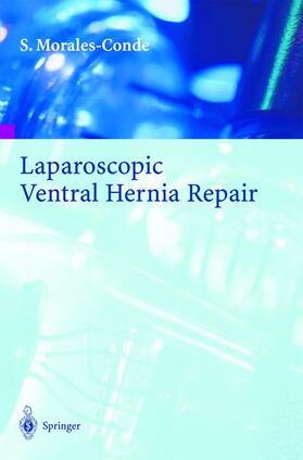 Morales-Conde |  Laparoscopic Ventral Hernia Repair | Buch |  Sack Fachmedien
