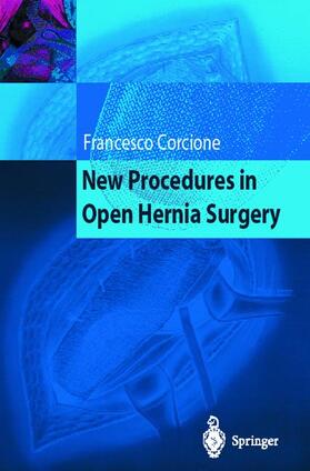Corcione |  New Procedures in Open Hernia Surgery | Buch |  Sack Fachmedien