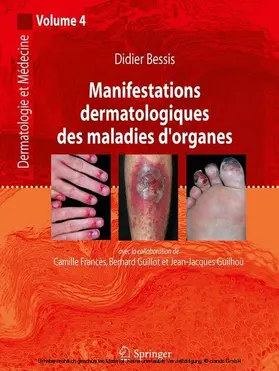 Bessis / Francès / Guillot |  Manifestations dermatologiques des maladies d'organes | eBook | Sack Fachmedien