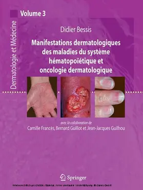 Bessis / Francès / Guillot |  Manifestations dermatologiques des maladies du système hématopoïétique et oncologie dermatologique | eBook | Sack Fachmedien