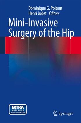 Poitout / Judet |  Mini-Invasive Surgery of the Hip | Buch |  Sack Fachmedien