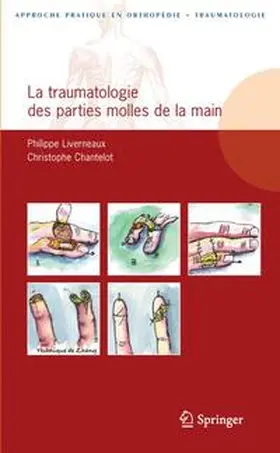 Liverneaux / Chantelot |  La traumatologie des parties molles de la main | Buch |  Sack Fachmedien