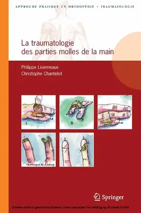 Liverneaux / Chantelot |  La traumatologie des parties molles de la main | eBook | Sack Fachmedien