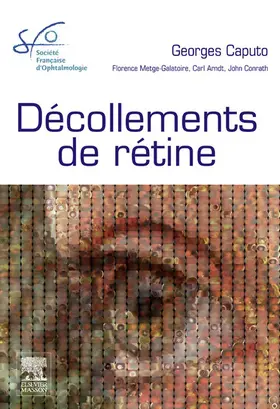 Caputo / Metge / Arndt |  Décollements de rétine | eBook | Sack Fachmedien