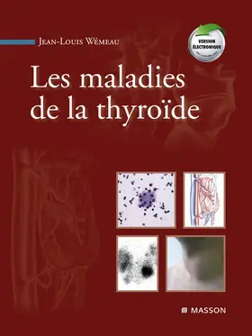 Wémeau |  Les maladies de la thyroïde | eBook | Sack Fachmedien