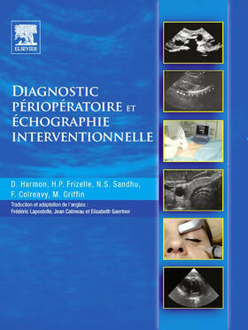 Harmon / Colreavy / Griffin |  Diagnostic périopératoire et échographie interventionnelle | eBook | Sack Fachmedien