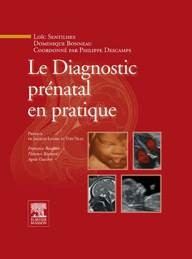 Descamps / Bonneau / Sentilhes |  Le Diagnostic prénatal en pratique | eBook | Sack Fachmedien