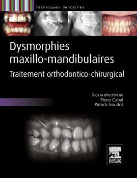 Canal / Goudot |  Dysmorphies maxillo-mandibulaires | eBook | Sack Fachmedien