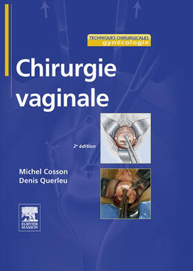 Cosson / Querleu |  Chirurgie vaginale | eBook | Sack Fachmedien