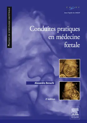 Benachi |  Conduites pratiques en médecine foetale | eBook | Sack Fachmedien