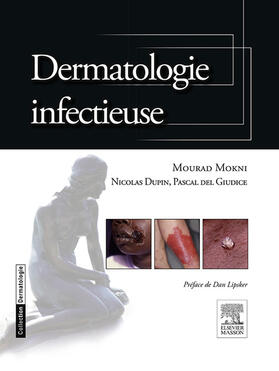 Mokni / Dupin |  Dermatologie infectieuse | eBook | Sack Fachmedien