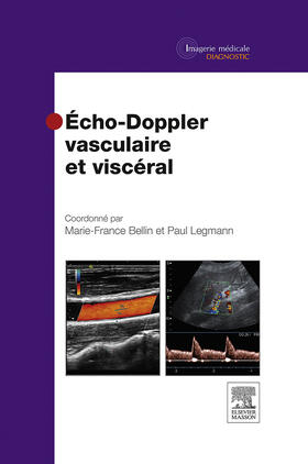 Bellin / Legmann |  Echo-Doppler vasculaire et viscéral | eBook | Sack Fachmedien