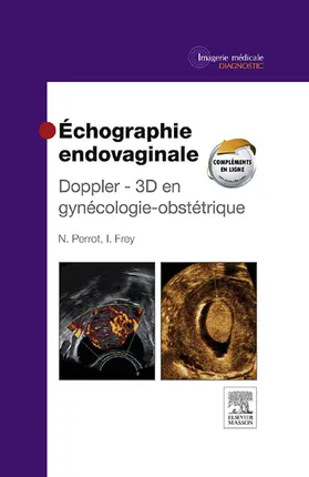 Perrot |  Échographie endovaginale Doppler - 3D | eBook | Sack Fachmedien